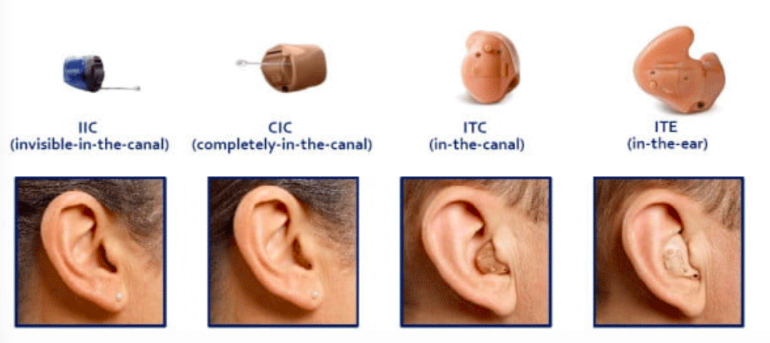 kulak-ici-isitme-cihazi-modelleri-ite-itc-cic-iic